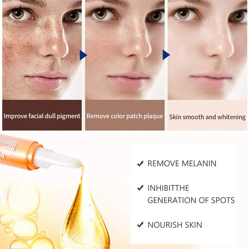 Instant Spot Gel VC Whitening Spot Serum Remove Melanin Melasma Brightening Intensive Whitening Cream Beauty Health
Instant Spot Gel VC Whitening Spot Serum Remove Melanin Melasma Brightening Intensive Whitening Cream Beauty Health