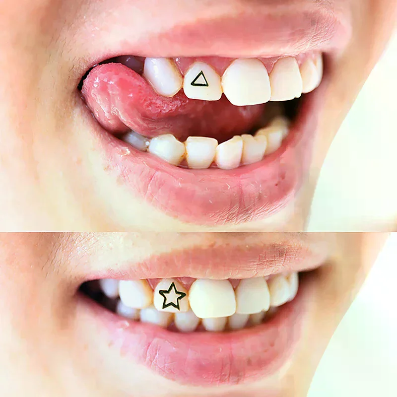 3 PCS/Box Teeth Gems Tooth Jewelry Crystal Ornaments Fashion Teeth Charms Gems With Box Metal Dental Supplies Oral Decorations
3 PCS/Box Teeth Gems Tooth Jewelry Crystal Ornaments Fashion Teeth Charms Gems With Box Metal Dental Supplies Oral Decorations