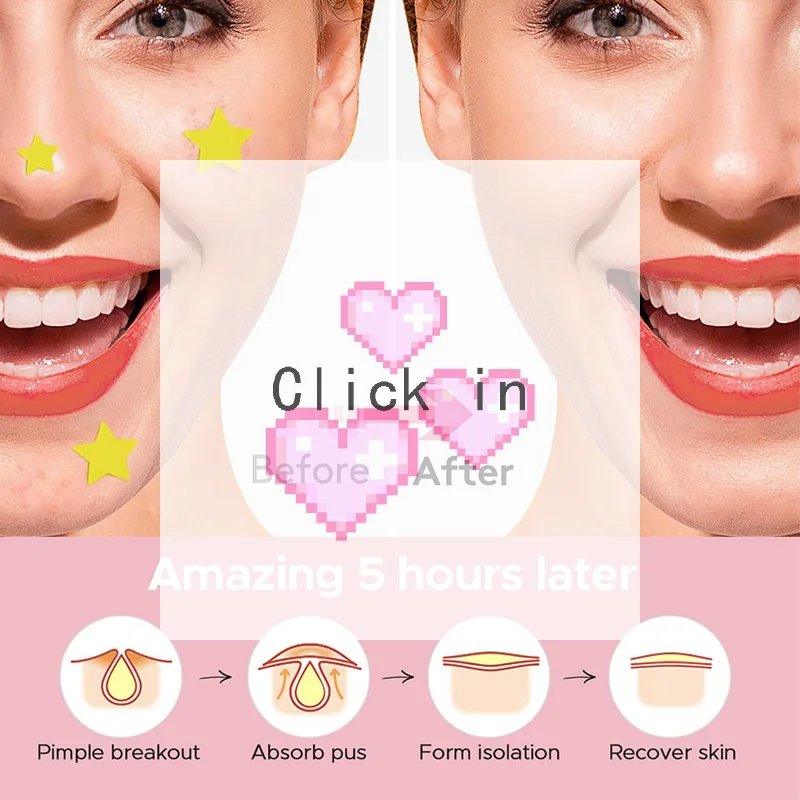 600 PCS/SET Star Pimple Patch Acne Colorful Invisible Acne Removal Skin Care Stickers Concealer Face Spot Beauty Makeup Tools
600 PCS/SET Star Pimple Patch Acne Colorful Invisible Acne Removal Skin Care Stickers Concealer Face Spot Beauty Makeup Tools