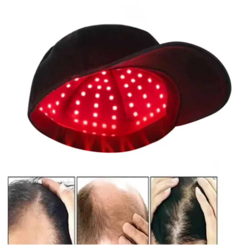 Новая инфракрасная шапка с 56/100 светодиодами для фототерапии, стимулирующая рост волос, против выпадения волос, расслабляющая кожу головы, для ухода за волосами
Новая инфракрасная шапка с 56/100 светодиодами для фототерапии, стимулирующая рост волос, против выпадения волос, расслабляющая кожу головы, для ухода за волосами