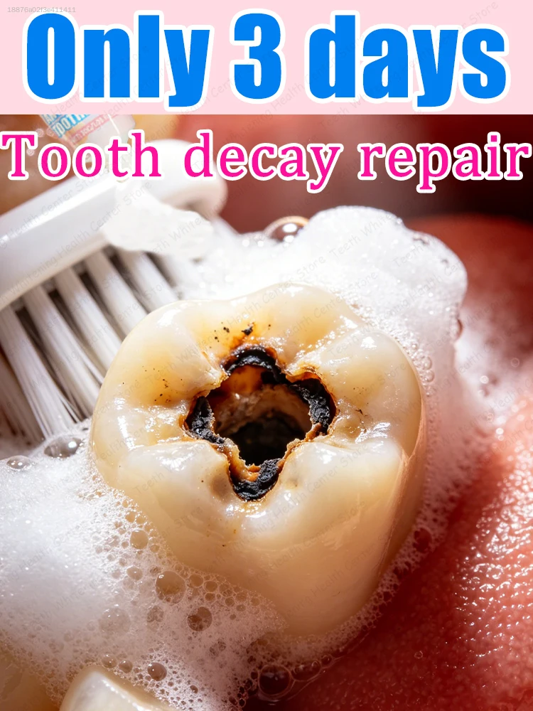 Strengthen the enamel barrier, making it less prone to cavities.
Strengthen the enamel barrier, making it less prone to cavities.