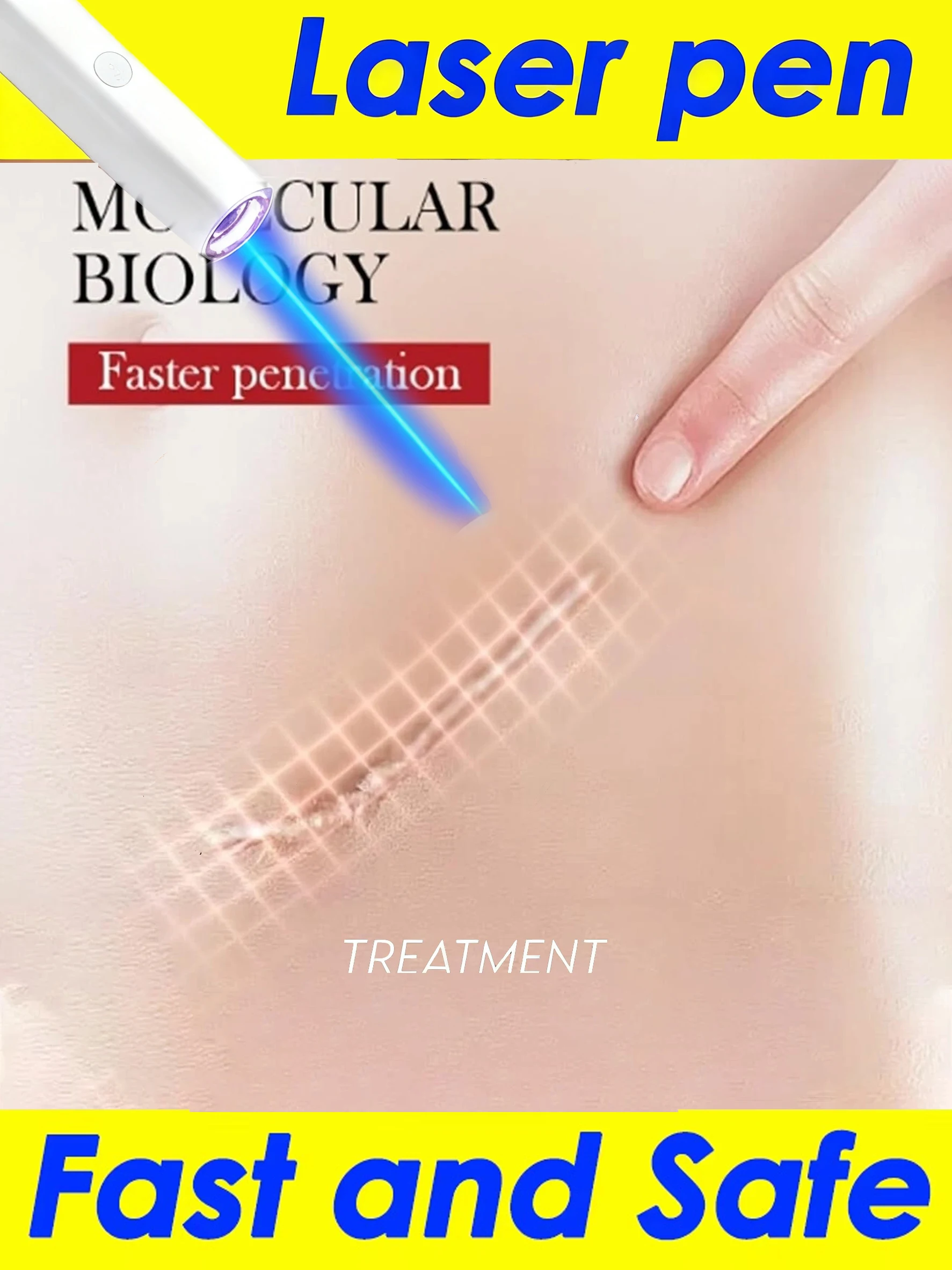 Laser pen, blue light gently penetrates the skin, deeply eliminates scars
Laser pen, blue light gently penetrates the skin, deeply eliminates scars