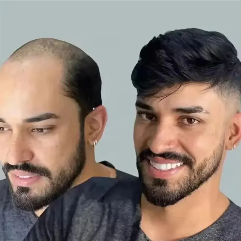 Soft Straight Men Toupee Mono+Pu Base Human Hair Wig Men's Capillary Prosthesis Durable System Australia French Lace Toupee
Soft Straight Men Toupee Mono+Pu Base Human Hair Wig Men's Capillary Prosthesis Durable System Australia French Lace Toupee