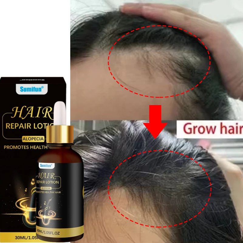 Fast Hair Growth Set Batana Oil Traction Alopecia Hair Mask Anti Break Loss Hair Growth Oil Baldness Treatment Hair Health Care
Fast Hair Growth Set Batana Oil Traction Alopecia Hair Mask Anti Break Loss Hair Growth Oil Baldness Treatment Hair Health Care