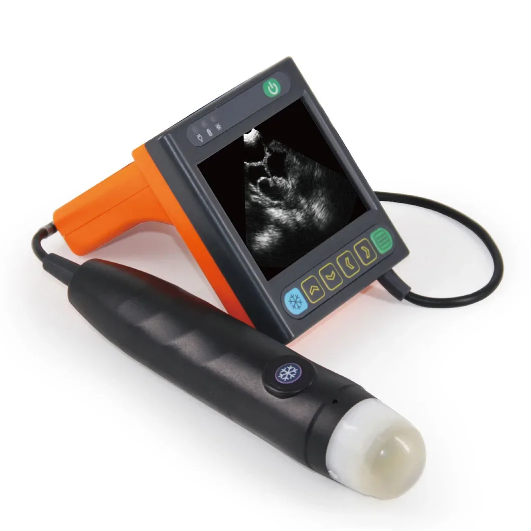 Lowest Price Veterinary Wrist Scanner for Livestock Farm
Lowest Price Veterinary Wrist Scanner for Livestock Farm