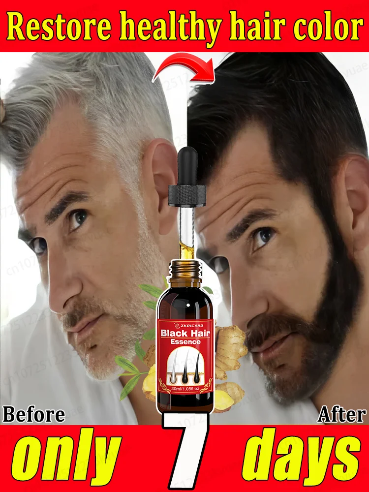 Сыворотка для волос против седых волос с биотином и растительным экстрактом, покрывает седые волосы и обратные белые волосы для мужчин и женщин, естественная формула травы
Сыворотка для волос против седых волос с биотином и растительным экстрактом, покрывает седые волосы и обратные белые волосы для мужчин и женщин, естественная формула травы