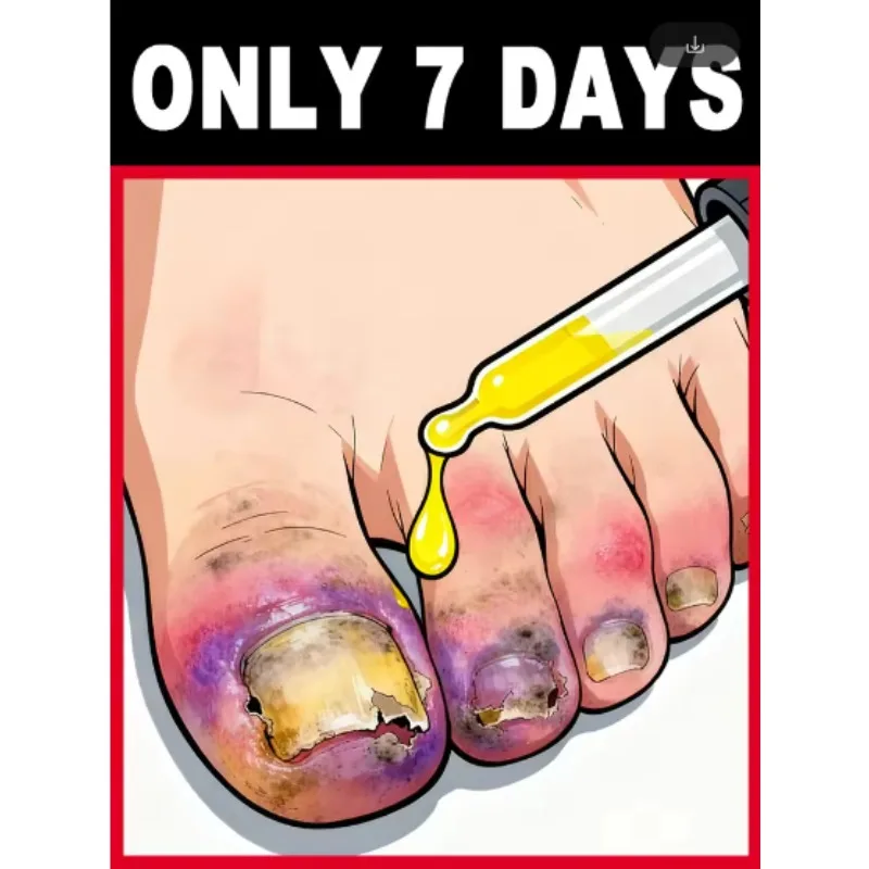 Protect the healthy environment of the ᶠᵉᵉᵗ ᵃⁿᵈ ᵃᵛᵒⁱᵈ ᵇᵃᶜᵗᵉʳⁱᵃˡ ⁱⁿᶠᵉᶜᵗⁱᵒⁿ
Protect the healthy environment of the ᶠᵉᵉᵗ ᵃⁿᵈ ᵃᵛᵒⁱᵈ ᵇᵃᶜᵗᵉʳⁱᵃˡ ⁱⁿᶠᵉᶜᵗⁱᵒⁿ