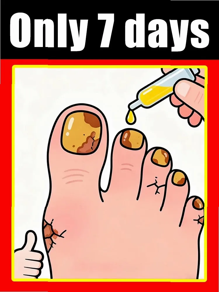 2025 Toenail Fungus Patch Waterproof Nail Repair Patches Nail Ingrown Correction Sticker Discolored Damaged Nail Foot Care Tool
2025 Toenail Fungus Patch Waterproof Nail Repair Patches Nail Ingrown Correction Sticker Discolored Damaged Nail Foot Care Tool