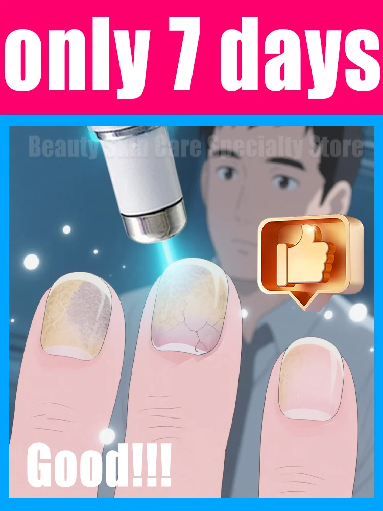 2025 Hot Sellers: Nail Cleaning Tools, Blue Light Laser Tools Root Repair Upgraded to Second Generation
2025 Hot Sellers: Nail Cleaning Tools, Blue Light Laser Tools Root Repair Upgraded to Second Generation