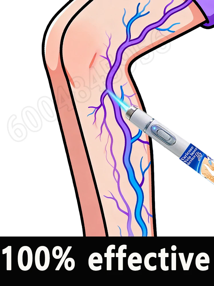 ᵀʰᵉ ᵗʰⁱʳᵈ⁻ᵍᵉⁿᵉʳᵃᵗⁱᵒⁿ nanolaser can eliminate inflammation and relieve pain, and comes with a ɪɴᴅɪᴄᴀᴛᴏ
ᵀʰᵉ ᵗʰⁱʳᵈ⁻ᵍᵉⁿᵉʳᵃᵗⁱᵒⁿ nanolaser can eliminate inflammation and relieve pain, and comes with a ɪɴᴅɪᴄᴀᴛᴏ
