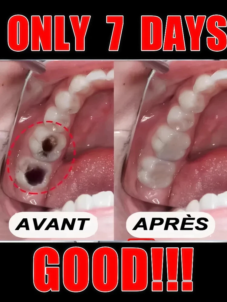 Восстановление горячих десен 2025 года, кровотечение зубов и боль в зубах во всем исчезать. Самая мощная технология
Восстановление горячих десен 2025 года, кровотечение зубов и боль в зубах во всем исчезать. Самая мощная технология