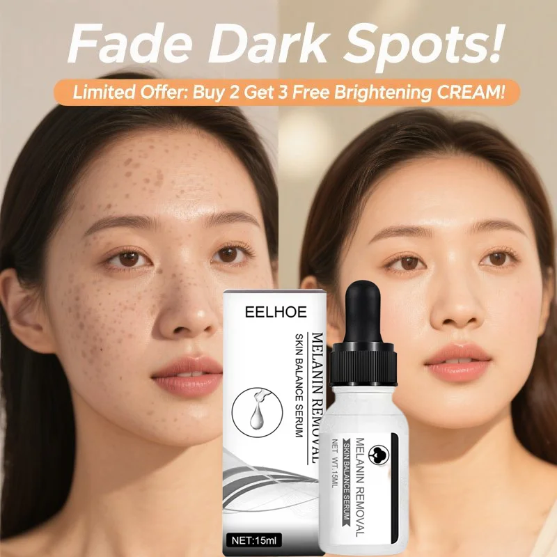 Dark Spots Remover Serum Freckle Whitening Whitening Moisture Powerful Removal Black Dot Melasma Chloasma Face Skin Care Cream
Dark Spots Remover Serum Freckle Whitening Whitening Moisture Powerful Removal Black Dot Melasma Chloasma Face Skin Care Cream
