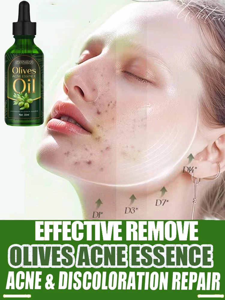 Skin Care Moisturizing Oil Acne Removal Serum Shrink Pores Oil-Control Brighten Serum,Diminish Acne, Repair Redness
Skin Care Moisturizing Oil Acne Removal Serum Shrink Pores Oil-Control Brighten Serum,Diminish Acne, Repair Redness