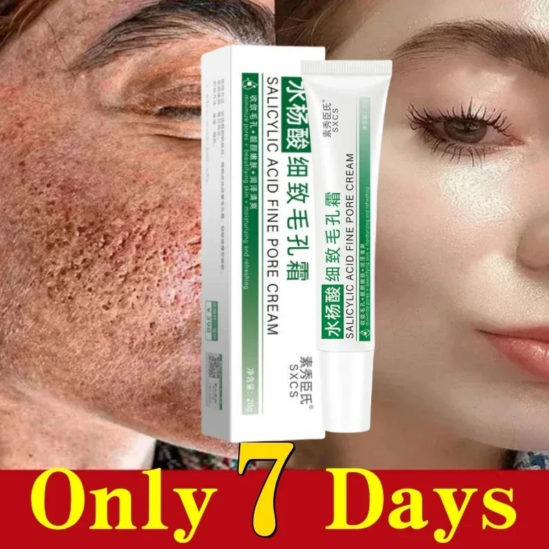 Pore Shrinking Cream Elimination Large Pores Blackehead Remove Acne Pit Repair Gel Tighten Face Smooth Skin Korean Care Products
Pore Shrinking Cream Elimination Large Pores Blackehead Remove Acne Pit Repair Gel Tighten Face Smooth Skin Korean Care Products