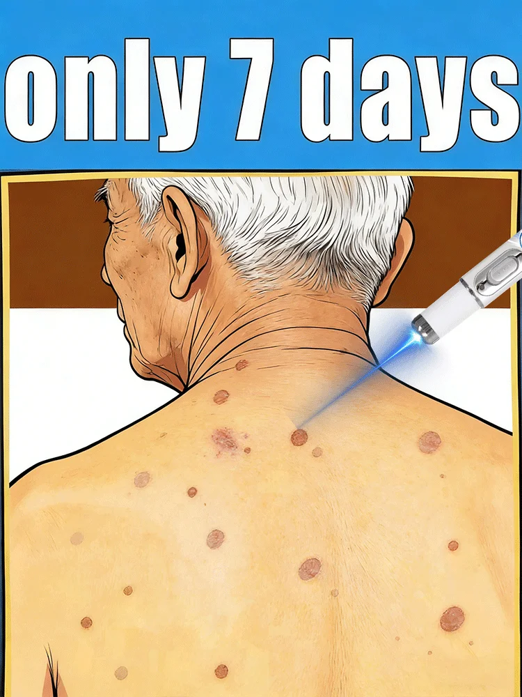 Инструмент для удаления бородавок синим светом, легко очищаемый инструмент для ухода за кожей
Инструмент для удаления бородавок синим светом, легко очищаемый инструмент для ухода за кожей