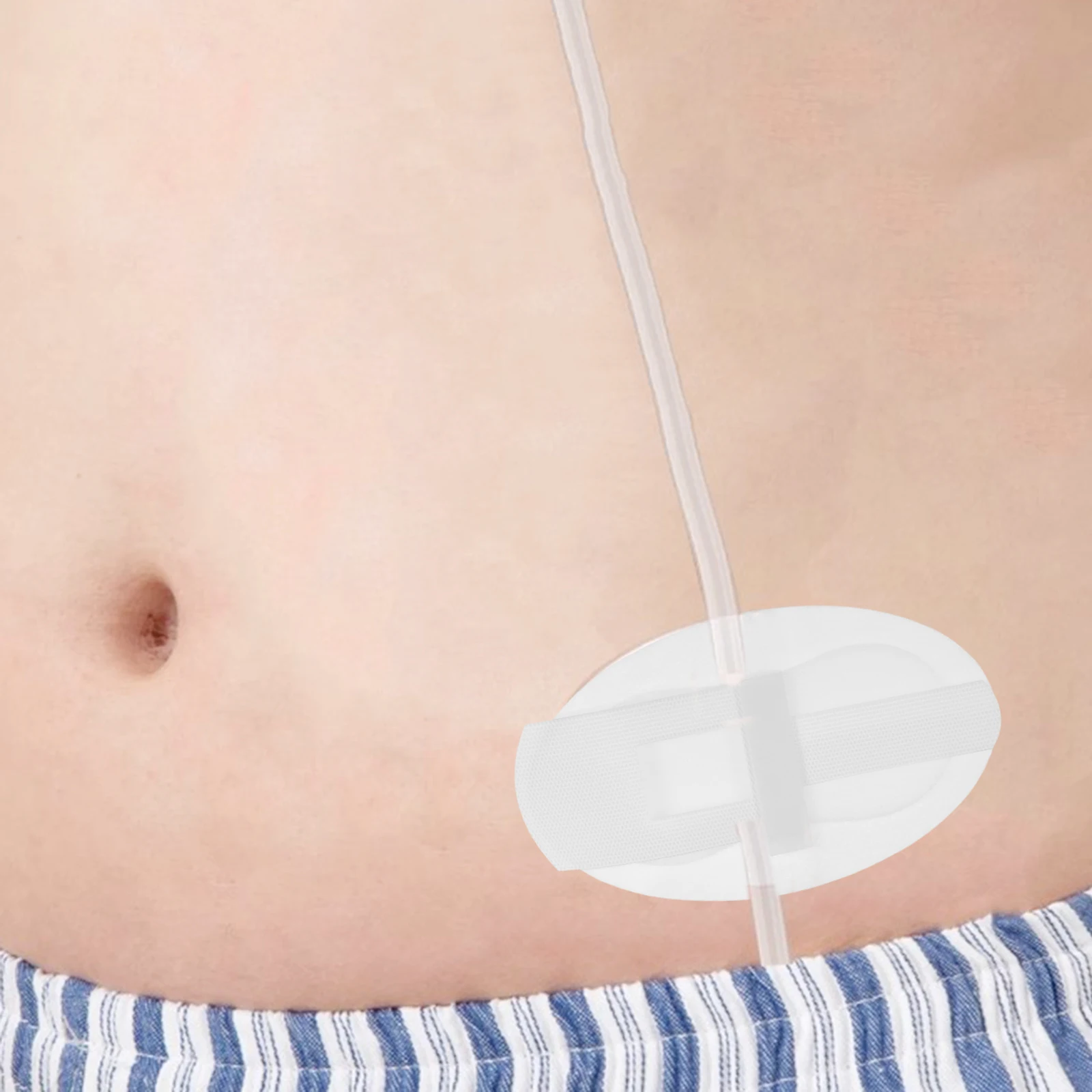 10pcs Fixation Sticker Breathable Comfortable Ureter Drainage Tube Catheter Sticker Fixator Secure Easy Paste 
10pcs Fixation Sticker Breathable Comfortable Ureter Drainage Tube Catheter Sticker Fixator Secure Easy Paste