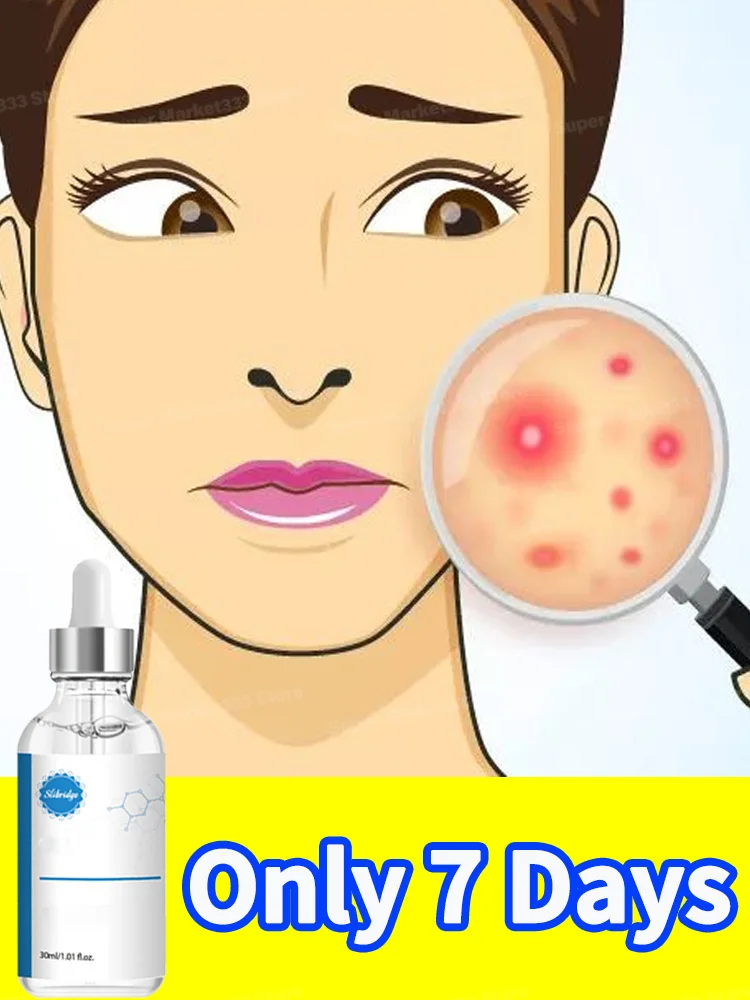 eliminates bad skin suitable for all age
eliminates bad skin suitable for all age