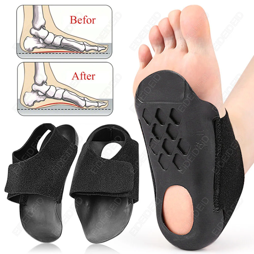 Orthopedic Insoles XO-Legs Orthotics Flat Foot Heel Cover Health Sole Pad For Shoes Insert Arch Support Pad For Plantar Fasciiti
Orthopedic Insoles XO-Legs Orthotics Flat Foot Heel Cover Health Sole Pad For Shoes Insert Arch Support Pad For Plantar Fasciiti