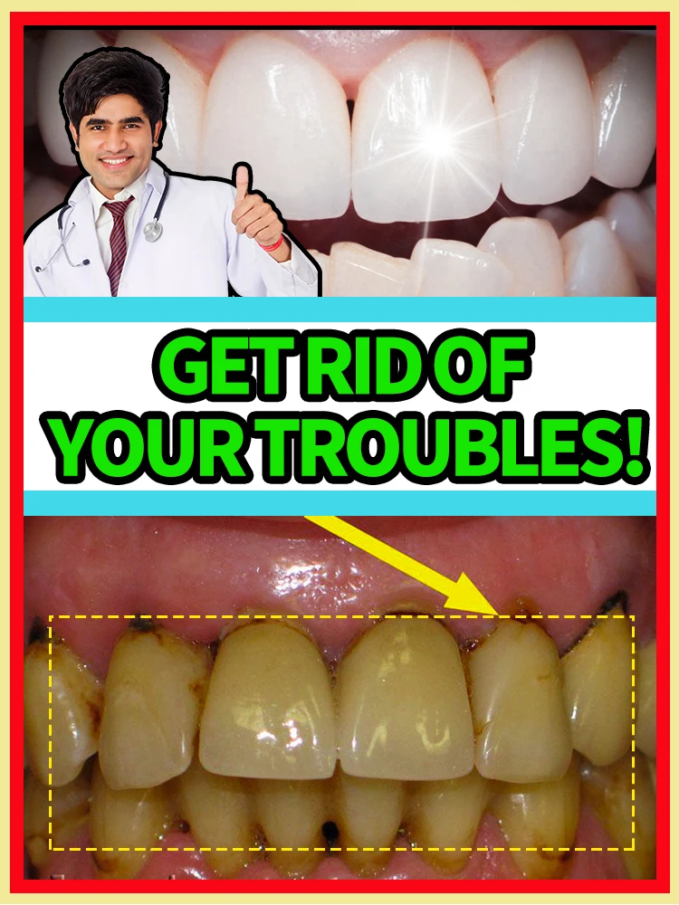 Clean up dental stones, freshen breath, whiten teeth, and show a confident smile
Clean up dental stones, freshen breath, whiten teeth, and show a confident smile