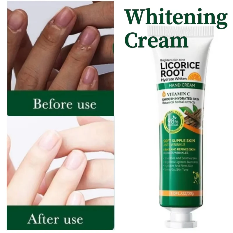 Lightening Dark Knuckles Cream Brighten Hand Cream Lighten Dull Corrector Moisturizing Stains Remover Products Skin Safe Care
Lightening Dark Knuckles Cream Brighten Hand Cream Lighten Dull Corrector Moisturizing Stains Remover Products Skin Safe Care