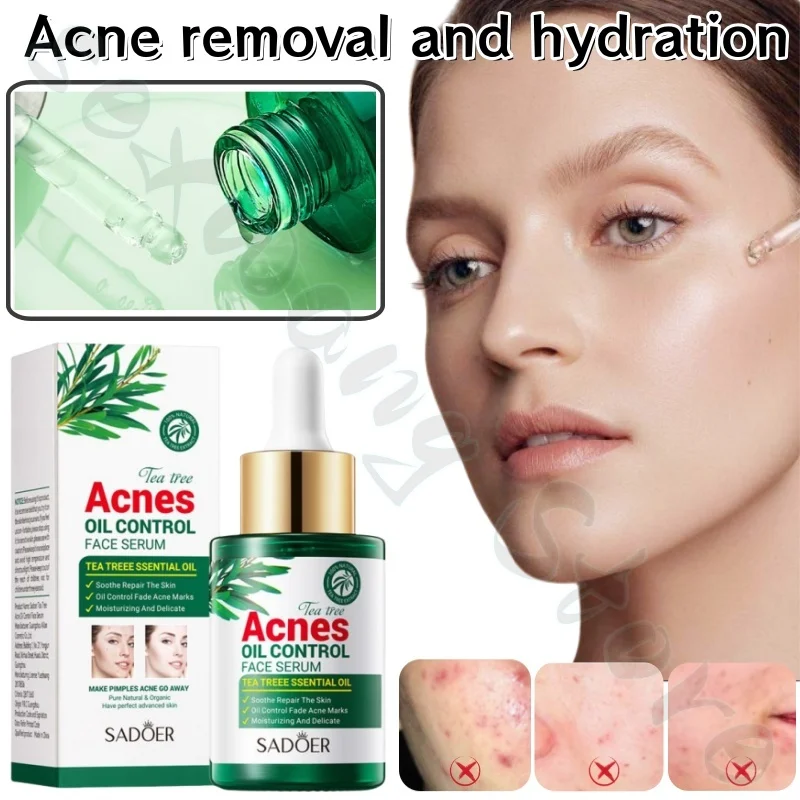 Tea Tree Essence 30ml moisturizing, moisturizing, refreshing, non-stick and improving facial dullness, acne balance water oil
Tea Tree Essence 30ml moisturizing, moisturizing, refreshing, non-stick and improving facial dullness, acne balance water oil