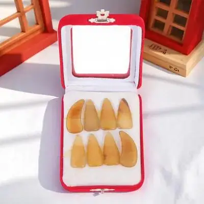 1 set Guzheng Fake Nails Iron Finger Nail Protectors Sturdy Covers for Stringed Instrument Fingertip Protection for Guzheng
1 set Guzheng Fake Nails Iron Finger Nail Protectors Sturdy Covers for Stringed Instrument Fingertip Protection for Guzheng