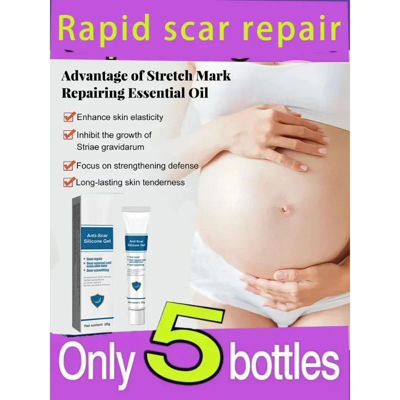 Eliminate Red White Old Stretch Marks Cream For Pregnancy Postpartum Skin Care Gel
Eliminate Red White Old Stretch Marks Cream For Pregnancy Postpartum Skin Care Gel