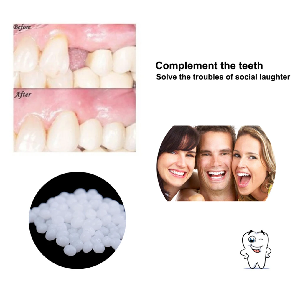 10/100g Dental Glue Temporary Solid Dental Restoration Kit Practical Tooth Hole Repair Materials Unisex Adults Tooth Beauty Tool
10/100g Dental Glue Temporary Solid Dental Restoration Kit Practical Tooth Hole Repair Materials Unisex Adults Tooth Beauty Tool