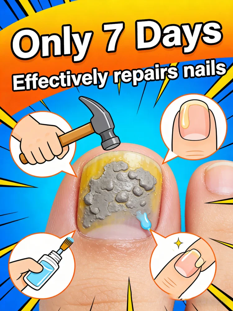 Extra Strength Nail Repair Serum Deep Penetration Care for Thickened Brittle Nails
Extra Strength Nail Repair Serum Deep Penetration Care for Thickened Brittle Nails