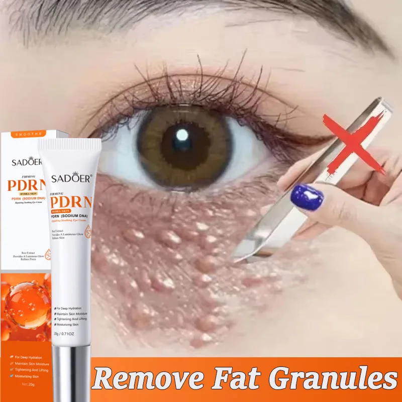 99% Salmon DNA Fat Granules Removal Eye Cream Milia Repair Products Anti Inflammatory Reduce Dark Circles Korean Skin Care
99% Salmon DNA Fat Granules Removal Eye Cream Milia Repair Products Anti Inflammatory Reduce Dark Circles Korean Skin Care