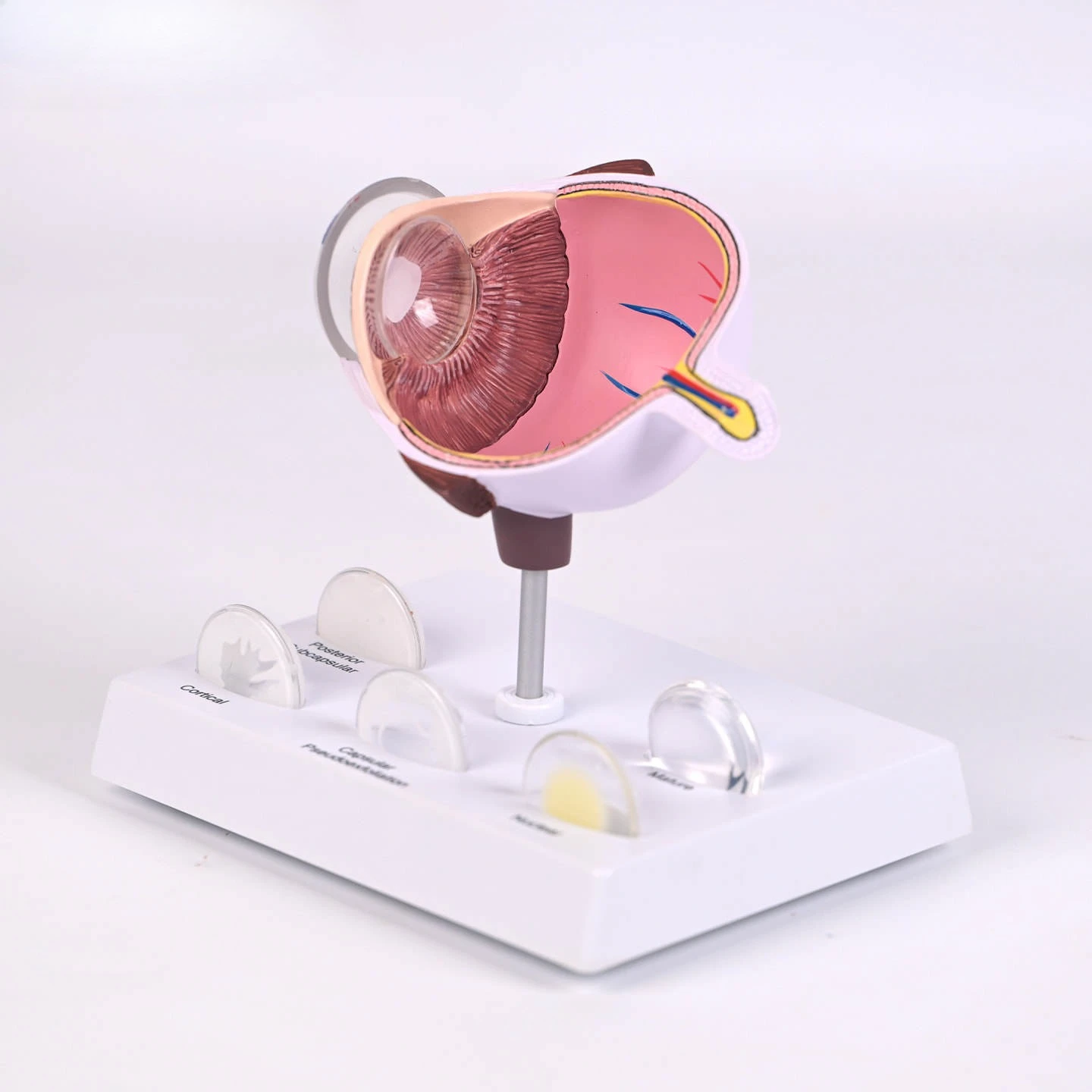 Медицинская модель глаза катаракта, анатомия глаз, патология, интенсивность линз, офтальмология, обучение
Медицинская модель глаза катаракта, анатомия глаз, патология, интенсивность линз, офтальмология, обучение