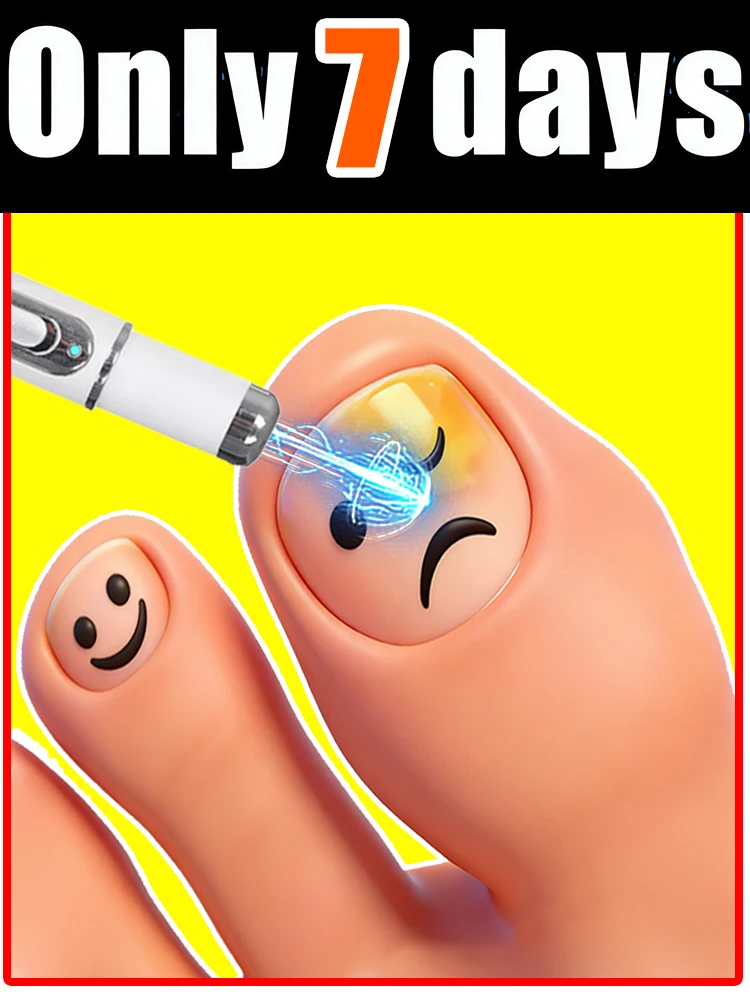 Say goodbye to Your Trouble nail laser penʜᴇʟᴘs ʏᴏᴜ sᴀʏ ɢᴏᴏᴅʙʏᴇ ᴛᴏ ᴏɴʏᴄʜᴏᴍʏᴄᴏsɪs.
Say goodbye to Your Trouble nail laser penʜᴇʟᴘs ʏᴏᴜ sᴀʏ ɢᴏᴏᴅʙʏᴇ ᴛᴏ ᴏɴʏᴄʜᴏᴍʏᴄᴏsɪs.