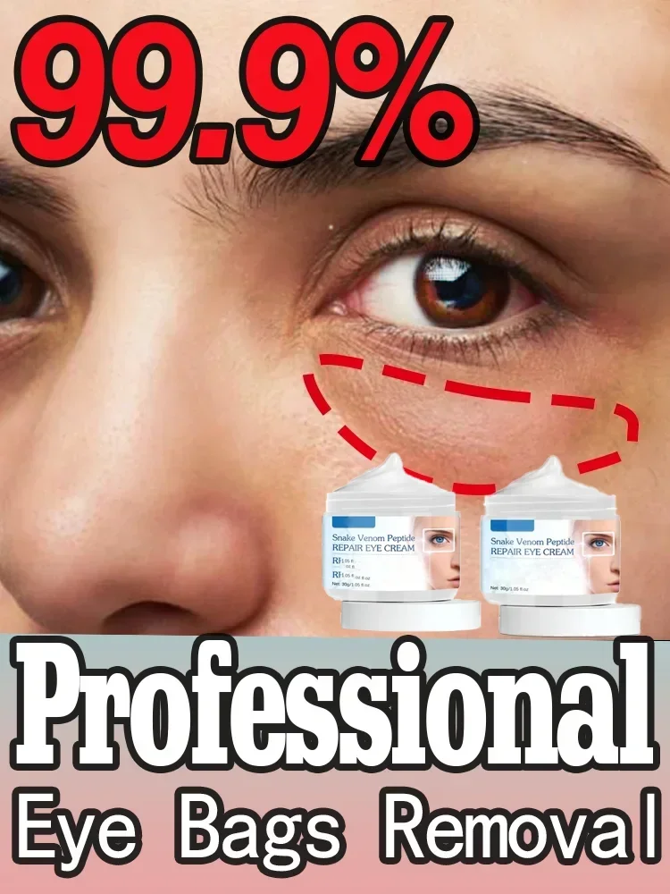 Eye Cream Reduces Dark Circles and Fine Lines Under Eyes Moisturizing Skin Eye Health Care
Eye Cream Reduces Dark Circles and Fine Lines Under Eyes Moisturizing Skin Eye Health Care