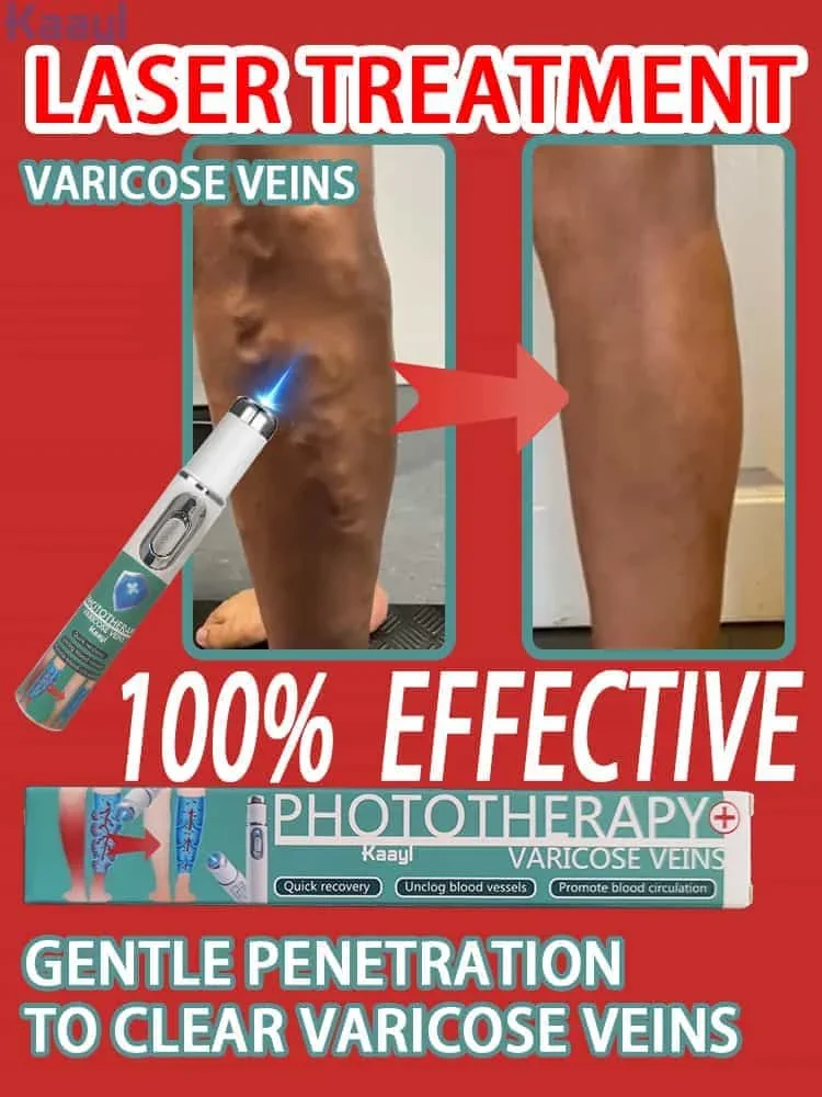 Improves Blood Circulation | Reduces Spider Veins and Heaviness | Support Circulation for Vein Health, Strength, and Function
Improves Blood Circulation | Reduces Spider Veins and Heaviness | Support Circulation for Vein Health, Strength, and Function