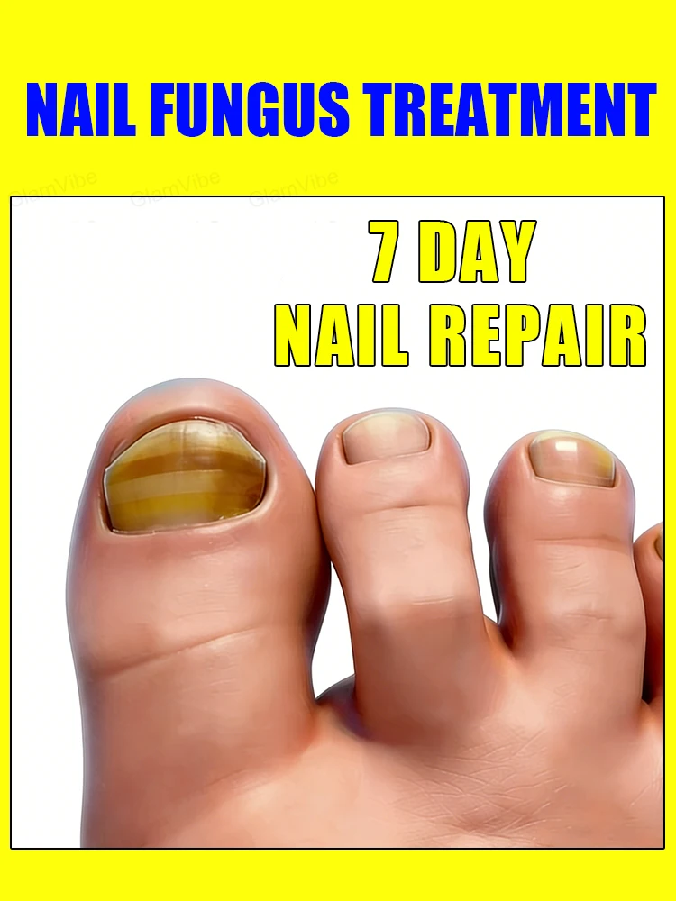 Say goodbye to yellowing & dullness, get transparent shiny nails
Say goodbye to yellowing & dullness, get transparent shiny nails