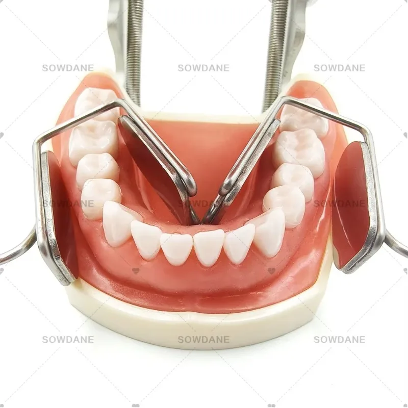 Stainless Steel Separator Retractors Lab Lip Cheek Isolator with Mirror Reflector. Best Tool
Stainless Steel Separator Retractors Lab Lip Cheek Isolator with Mirror Reflector. Best Tool