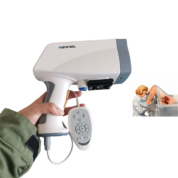 Medical Device HD Digital Video Handheld Electronic with Software for Gynecology
Medical Device HD Digital Video Handheld Electronic with Software for Gynecology