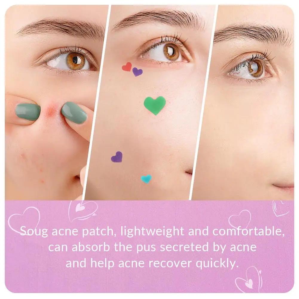 Love Shape Acne Pimple Patch Stickers Blemish Spot Concealer Cover 0.1mm Acne Treatment Pimple Remover Skin Care
Love Shape Acne Pimple Patch Stickers Blemish Spot Concealer Cover 0.1mm Acne Treatment Pimple Remover Skin Care