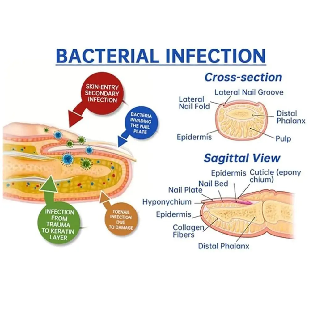 Устройство для лечения ногтей на ногах, устройство для фотосъемки чистых ногтей, высокоеэффективное устройство для лечения грибка ногтей, портативное, перезаряжаемое
Устройство для лечения ногтей на ногах, устройство для фотосъемки чистых ногтей, высокоеэффективное устройство для лечения грибка ногтей, портативное, перезаряжаемое