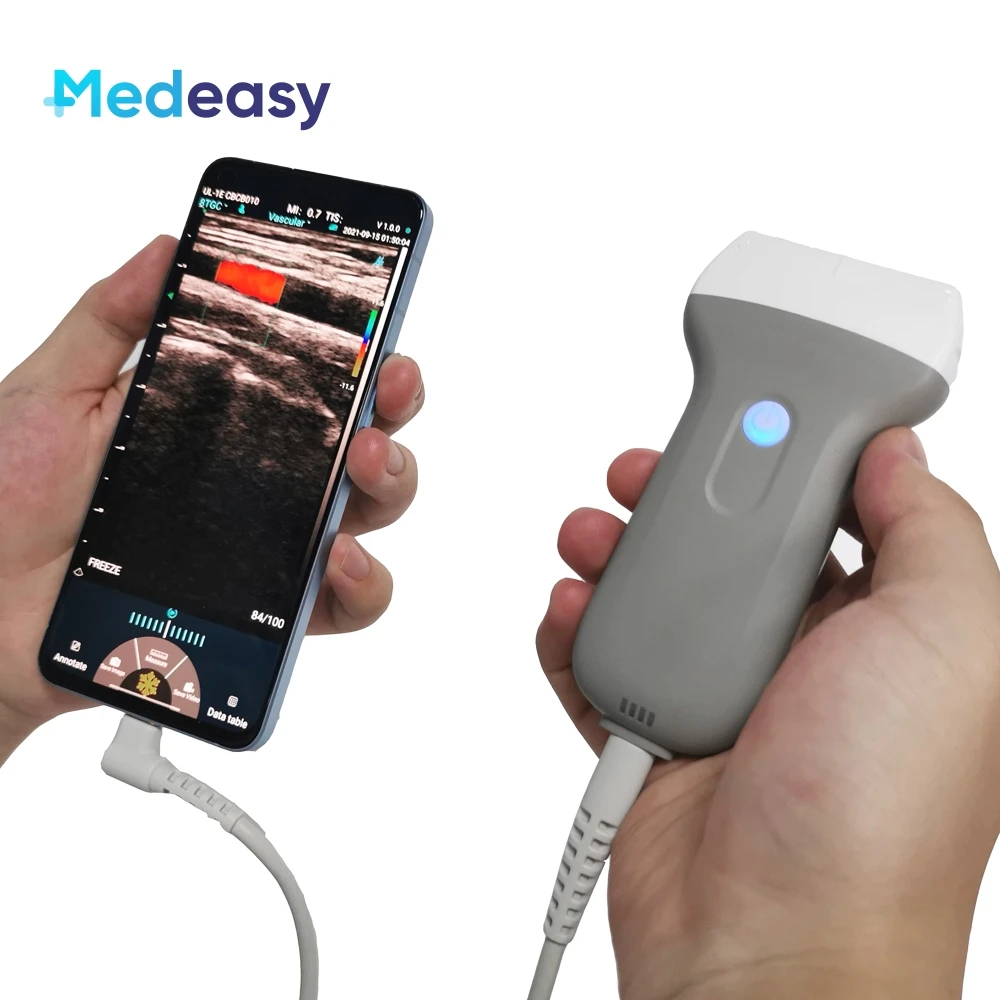 Горячая распродажа: портативный беспроводной ультразвуковой аппарат с цветным допплером (7.5/10 МГц), USB и Wi-Fi, линейный датчик
Горячая распродажа: портативный беспроводной ультразвуковой аппарат с цветным допплером (7.5/10 МГц), USB и Wi-Fi, линейный датчик