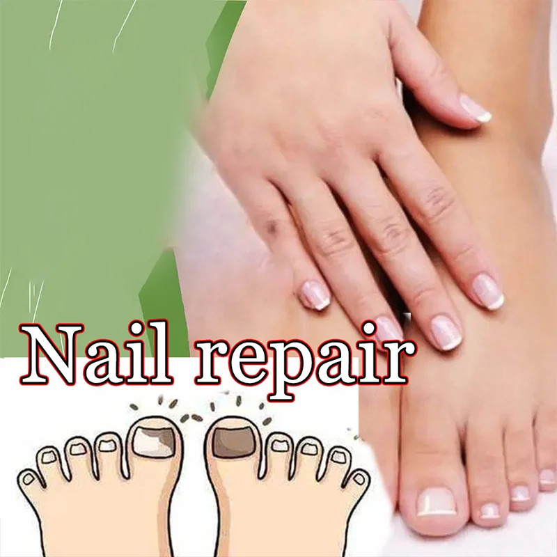 Discolored Damaged Nail Foot Care Tool Toenail Fungus Patch Waterproof Nail Repair
Discolored Damaged Nail Foot Care Tool Toenail Fungus Patch Waterproof Nail Repair