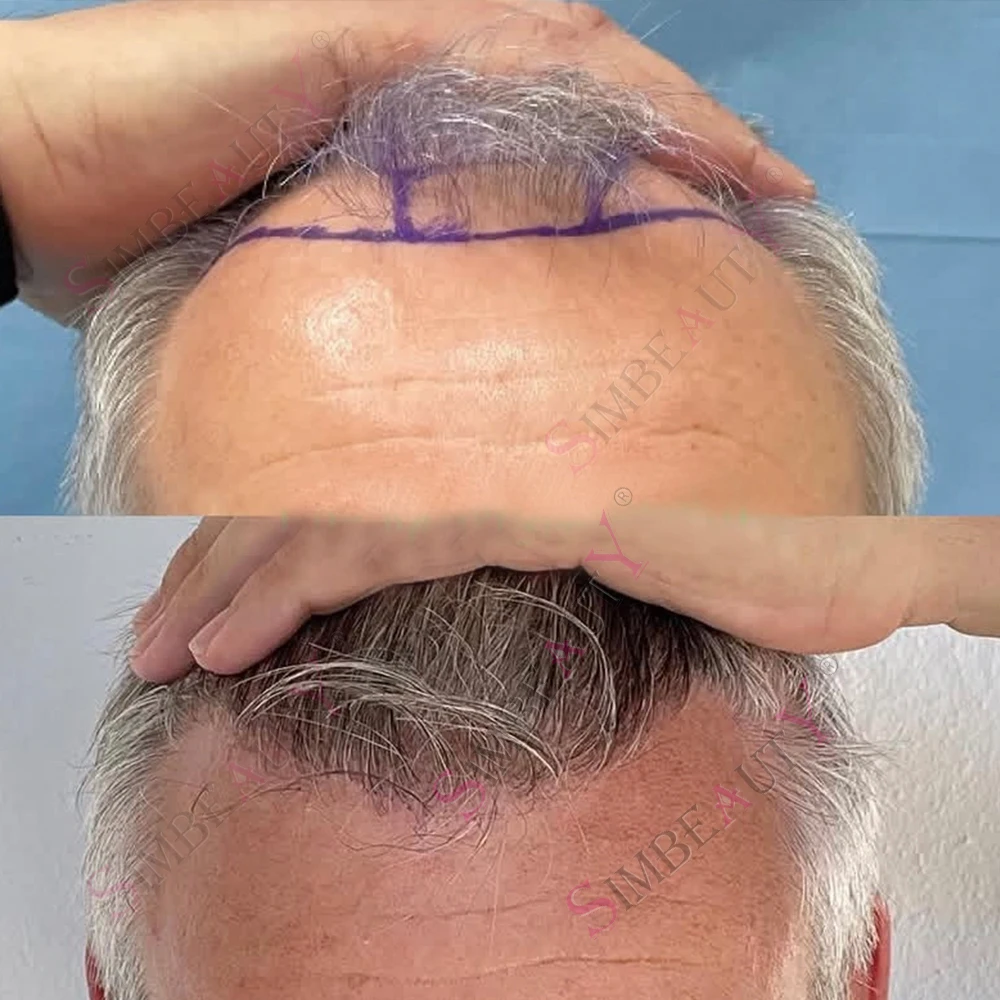 1B65 1B80 #540 White Grey 0.02mm Super Ultra Thin Skin 80Density Remy Blonde Human Hair Toupee for Men Capillar Prosthesi System
1B65 1B80 #540 White Grey 0.02mm Super Ultra Thin Skin 80Density Remy Blonde Human Hair Toupee for Men Capillar Prosthesi System