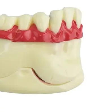 Dental Endodontic Treatment Model Right Side Mandible Anatomy for Gum and Tissue Study Dental Training Educational Tool
Dental Endodontic Treatment Model Right Side Mandible Anatomy for Gum and Tissue Study Dental Training Educational Tool