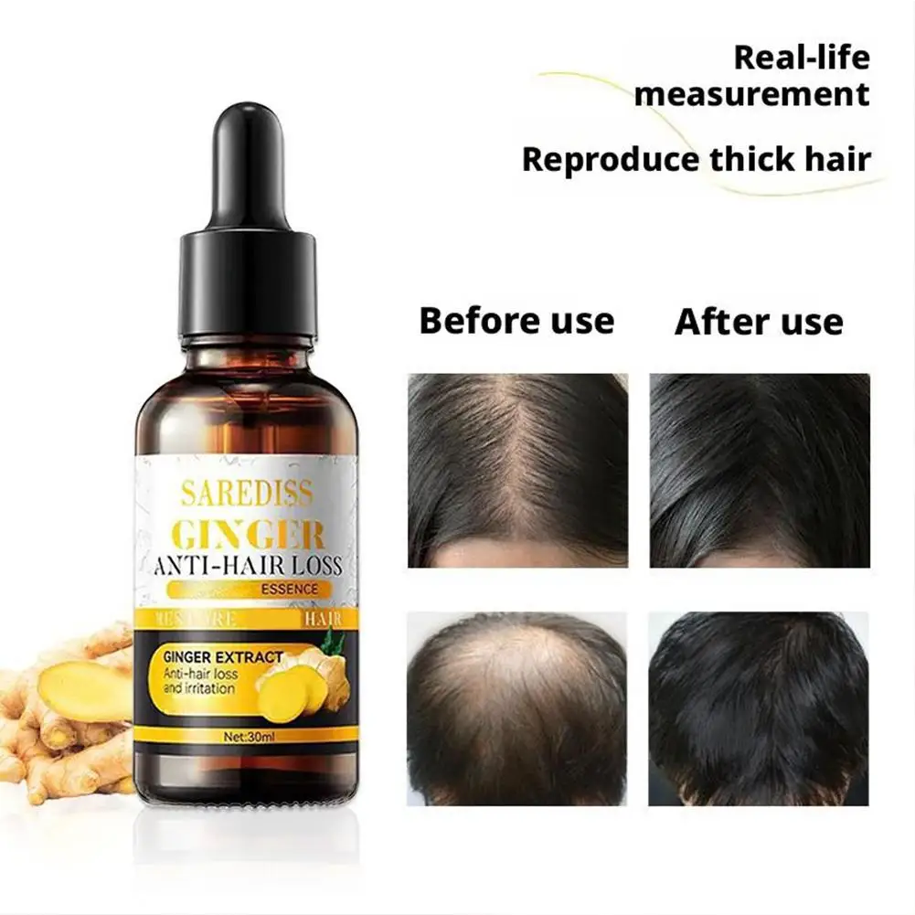 30ml Hair Strengthening Oil Ginger Biotin Essential Split Ends Nourishing Oils Treatment Dry Types All R2Y7
30ml Hair Strengthening Oil Ginger Biotin Essential Split Ends Nourishing Oils Treatment Dry Types All R2Y7