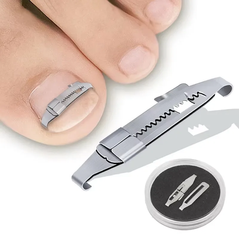 Toe Ingrown Pedicure Nail Buckle Toenails Corrector Foot Care Nail Correction Tool Straightening Clip Curved Brace Corrector
Toe Ingrown Pedicure Nail Buckle Toenails Corrector Foot Care Nail Correction Tool Straightening Clip Curved Brace Corrector