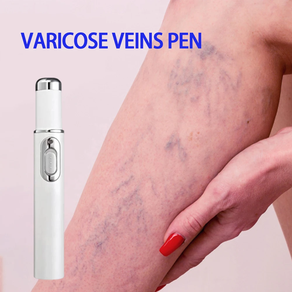 Remove Vasculitis Phlebitis Tools For Men And Woman Repair Laser Pen Relieves Leg Bulge Varicose Vein
Remove Vasculitis Phlebitis Tools For Men And Woman Repair Laser Pen Relieves Leg Bulge Varicose Vein