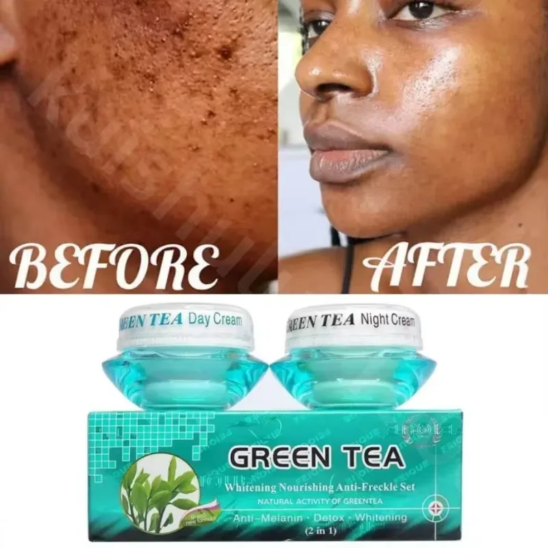 Green Tea Whitening Nourishing Anti-freckle Set Natural Whitening Freckle Day Activity Removal Cream Cream Night Greentea
Green Tea Whitening Nourishing Anti-freckle Set Natural Whitening Freckle Day Activity Removal Cream Cream Night Greentea