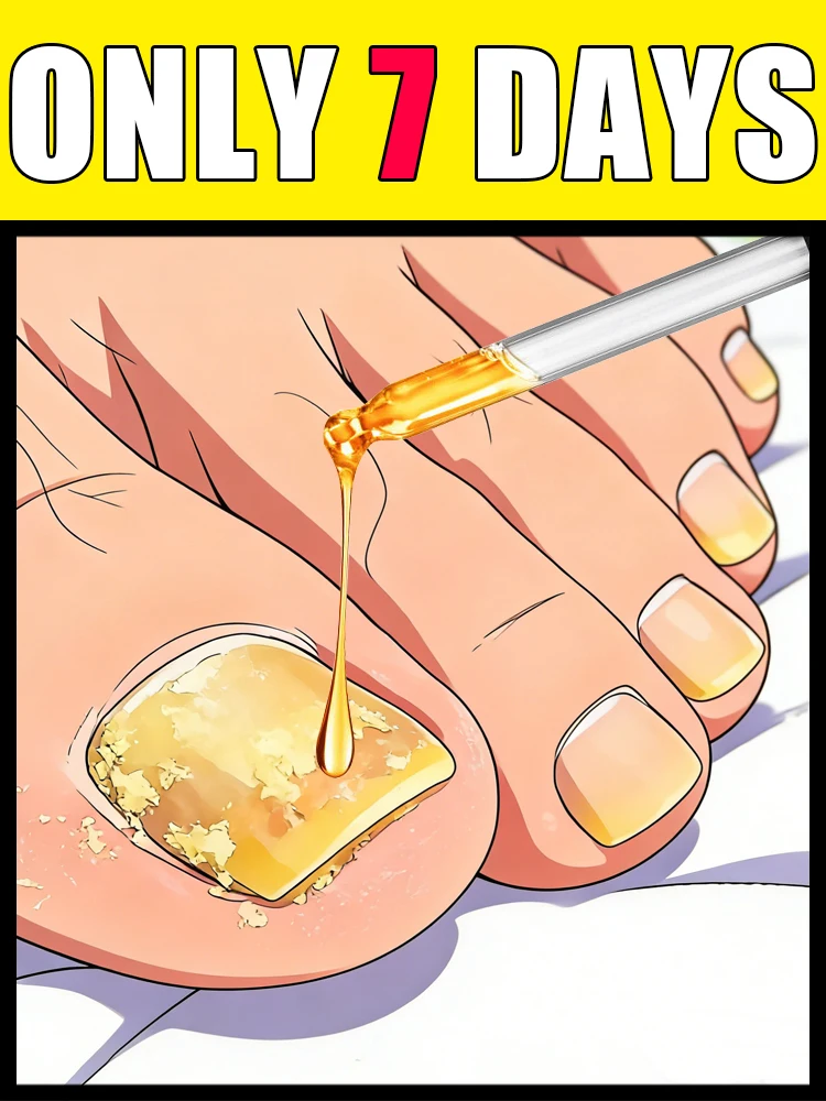 2026 No problem, no more worries about nails, and say no to yellowing in 7 days ,unisex
2026 No problem, no more worries about nails, and say no to yellowing in 7 days ,unisex