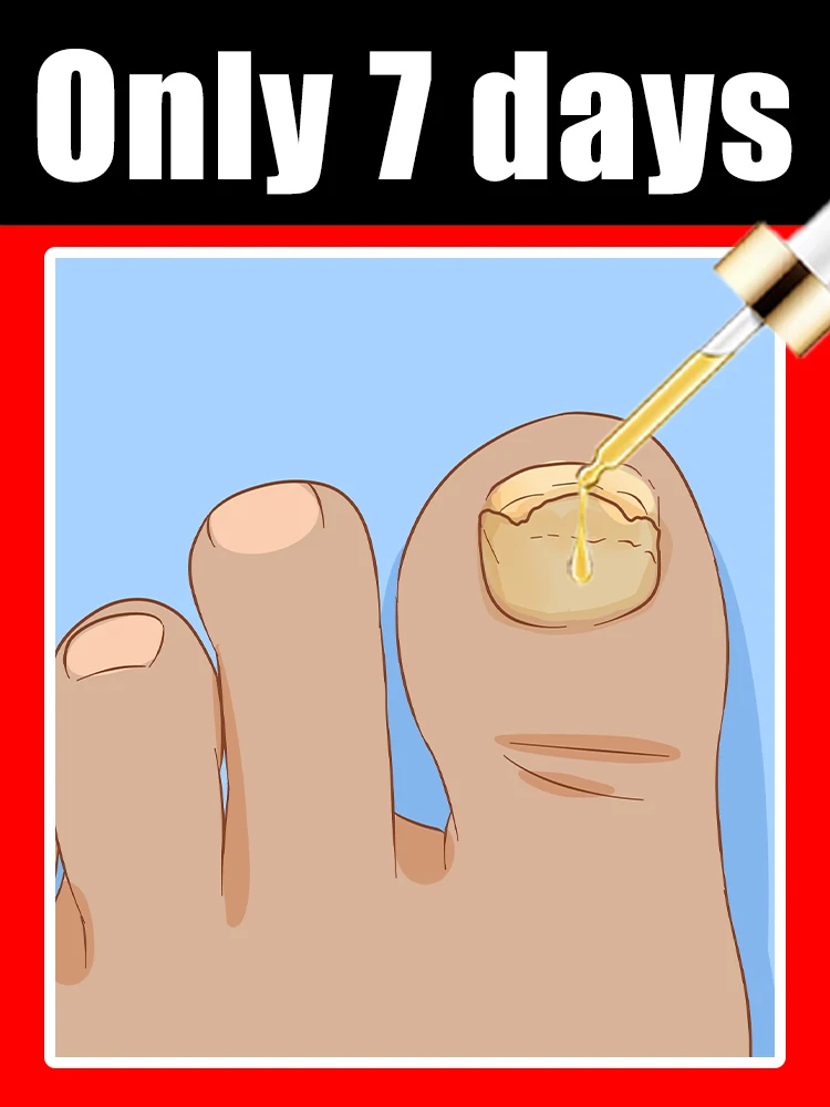 Омолаживающее средство - Технология предотвращения грибка - Регулируемое управление и датчик безопасности12
Омолаживающее средство - Технология предотвращения грибка - Регулируемое управление и датчик безопасности12