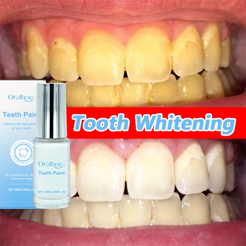 Teeth Care Paint Removal Coffee Stains Smoke Stains Oral Cleaning Teeth Stains Cleaning Teeth Refreshing Care Solution TeethCare
Teeth Care Paint Removal Coffee Stains Smoke Stains Oral Cleaning Teeth Stains Cleaning Teeth Refreshing Care Solution TeethCare